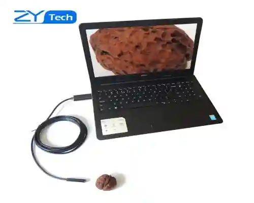 ANDROID ENDOSCOPE